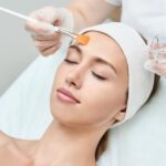 Skin Peel