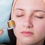 Micro Needling