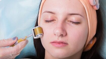 Micro Needling